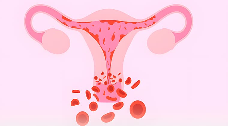 Sangrado menstrual anormal